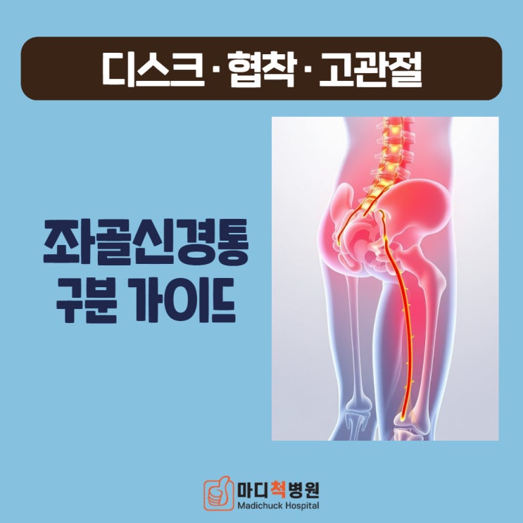 김포마디척 좌골 신경통 구분 가이드(디스크/협착/고관절) : 네이버 블로그