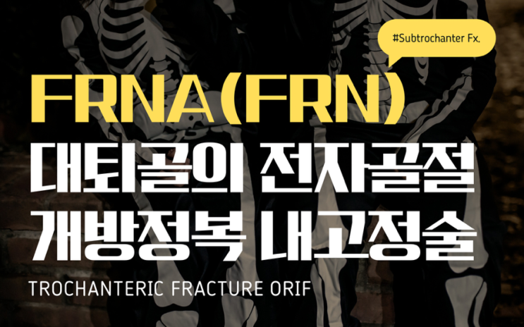 FRNA(FRN), Trochanteric Fracture ORIF 대퇴골의 전자 골절 양상에 따른 개방정복 내고정술의 종류 ...