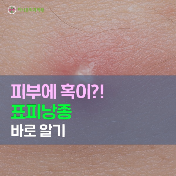 표피낭종 피부에 혹이 만져진다면? : 네이버 블로그