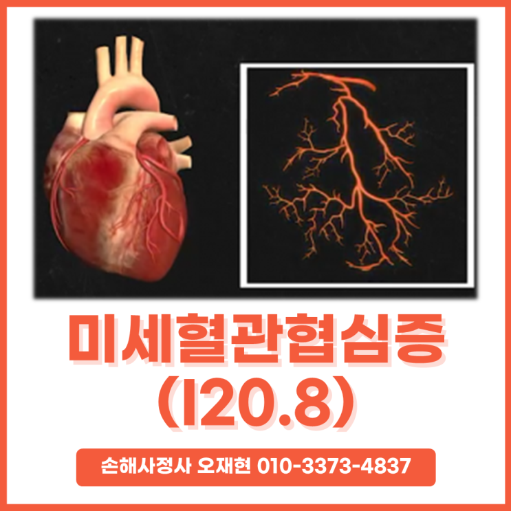 미세혈관협심증(Microvascular Angina, MVA) 보험금 받기 어렵습니다. : 네이버 블로그