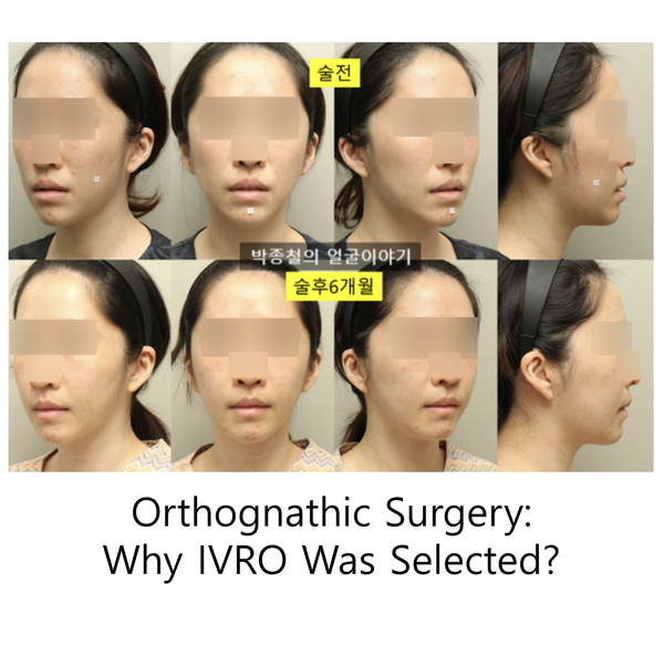 Orthognathic Surgery Methods: Why IVRO Was Selected and How a Custom ...