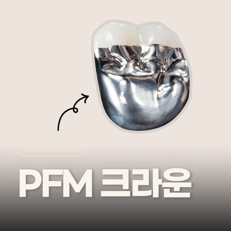 PFM 크라운 가격 보다 중요한 과정 : 네이버 블로그