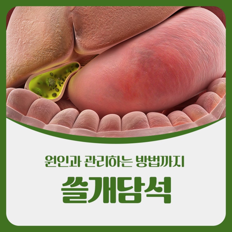 쓸개담석 원인부터 관리하는 방법까지 쓸개담석에 대한 모든 것 : 네이버 블로그