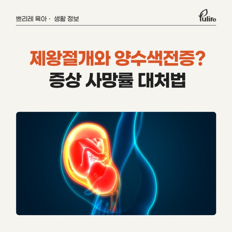 제왕절개와 양수색전증 관계는? 증상 사망률 대처법 정리 : 네이버 블로그