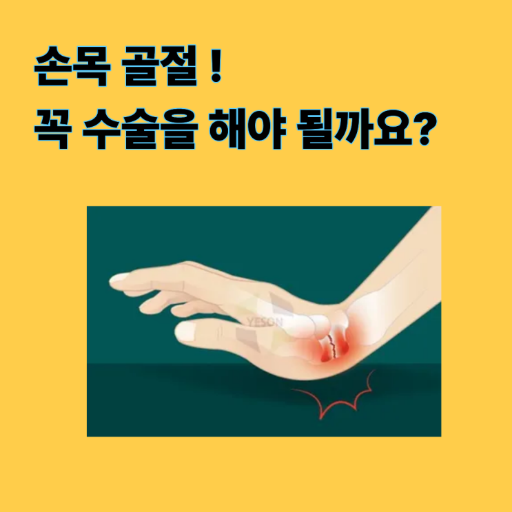 손목 골절, '원위 요골 골절' 수술 꼭 필요한가요? : 네이버 블로그