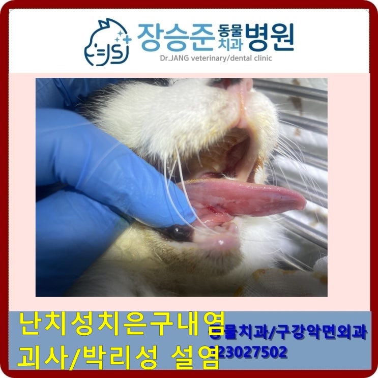 [치과연구소] 궤양성/박리성 설염/ 난치성치은구내염-후유증 : 네이버 블로그