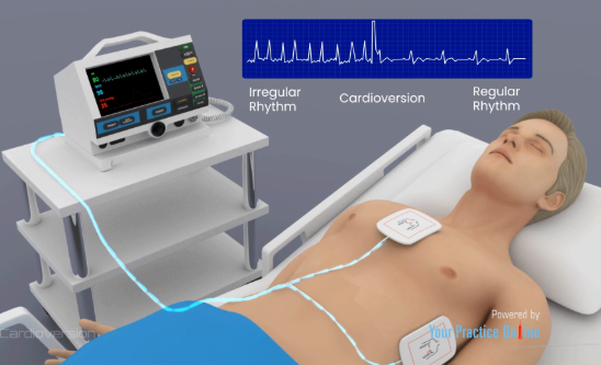 tachycardia CPR, cardioversion, defibrilator : 네이버 블로그