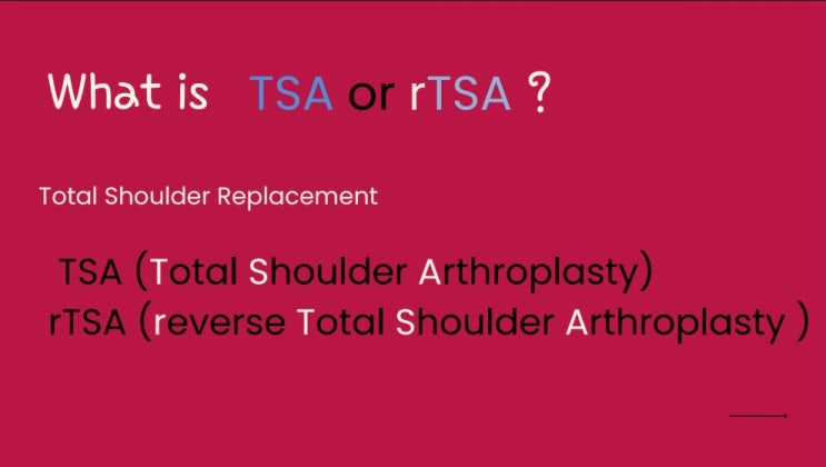 Shoulder Arthroplasty / rTSA : 네이버 블로그