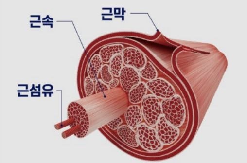 근막통증증후군VS근육통[김천헬스,김천헬스장,김천피티,김천다이어트,김천재활운동] : 네이버 블로그