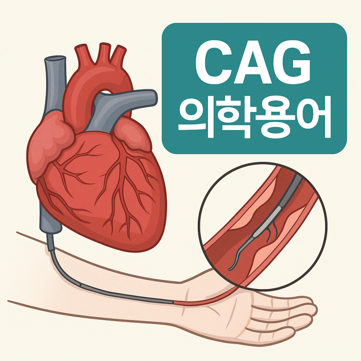 의학용어 CAG란 무엇일까? : 네이버 블로그
