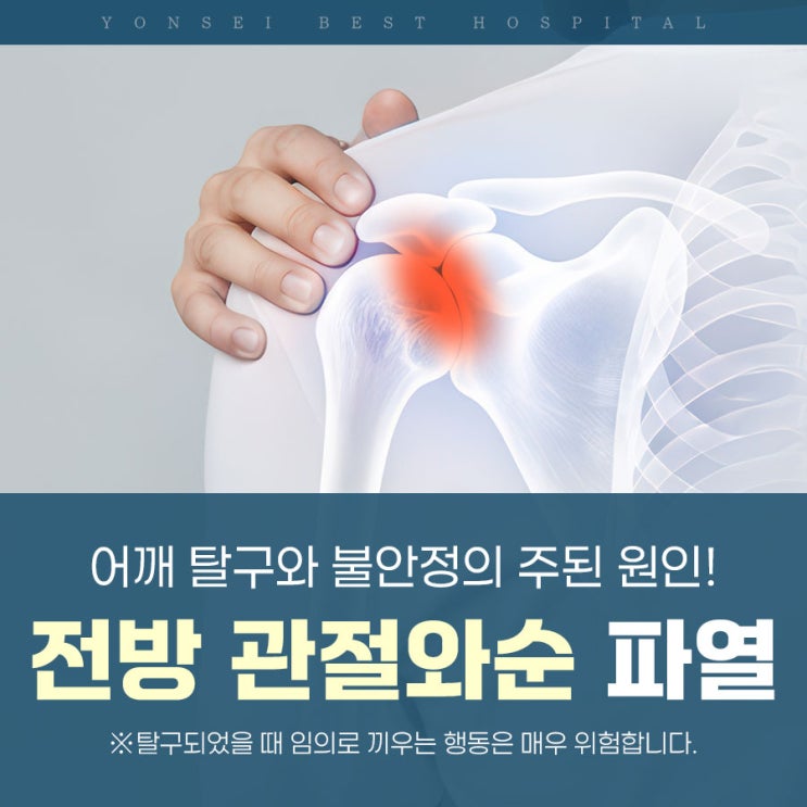 전방 관절와순 파열 원인, 증상, 치료 : 네이버 블로그