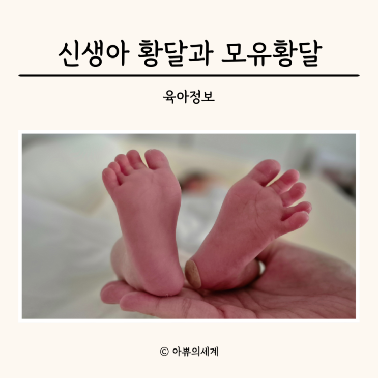 신생아 황달 수치 검사 증상 모유황달 모유수유 : 네이버 블로그