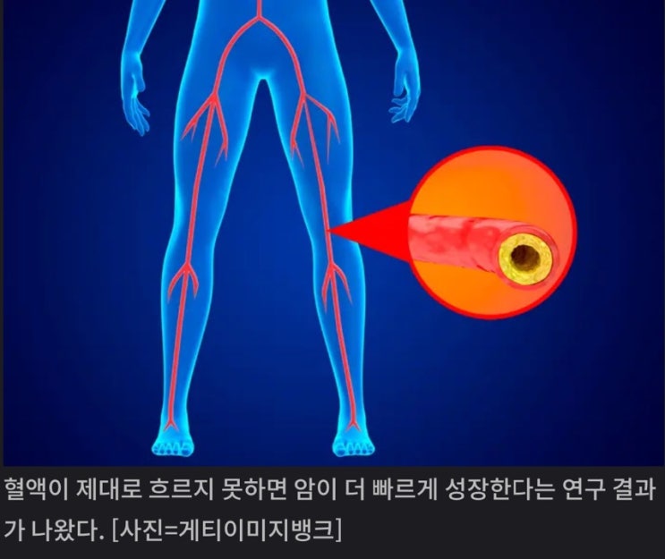 혈관 건강이 곧 암 예방 , 혈류 장애와 유방암 연구 결과 : 네이버 블로그