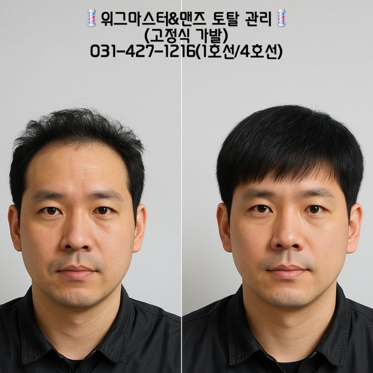 남자가발가격 │ 인모·혼모·합사 비교표+숨은 비용까지 총정리 : 네이버 블로그