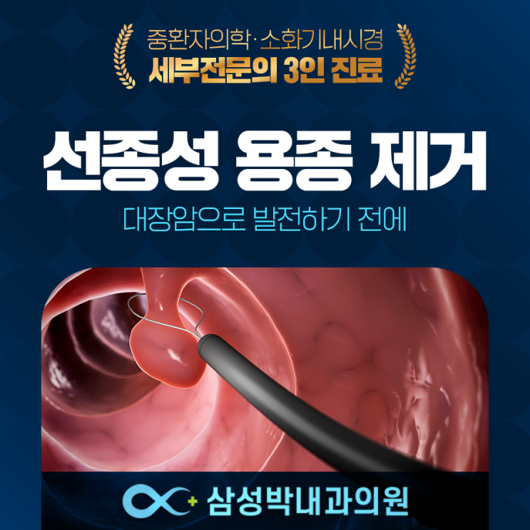 선종성 용종 제거 대장암으로 발전하기 전에 : 네이버 블로그