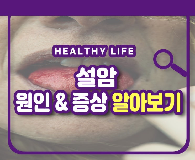 설암 초기증상 원인 구내염 특징과 구별하세요 : 네이버 블로그