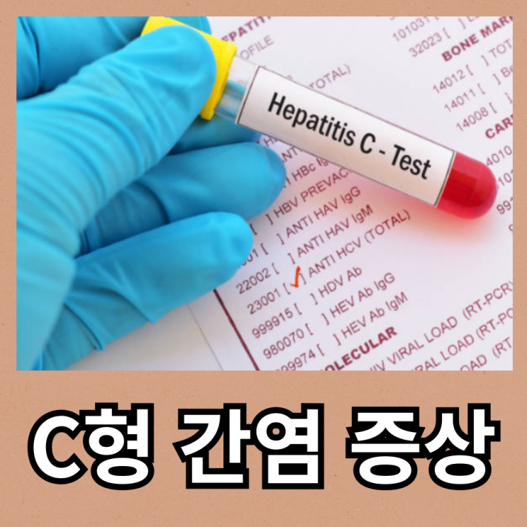 C형 간염 증상 전염 경로 항체 치료 알아보기 : 네이버 블로그