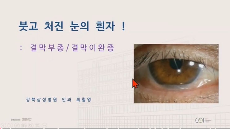 chatgpt 가 알려준 결막이완증(feat 짓봇아~네가 의사보다 낫다) : 네이버 블로그