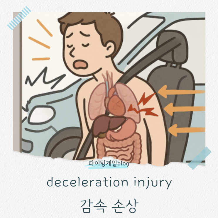 deceleration injury, 감속 손상이 무엇일까? : 네이버 블로그