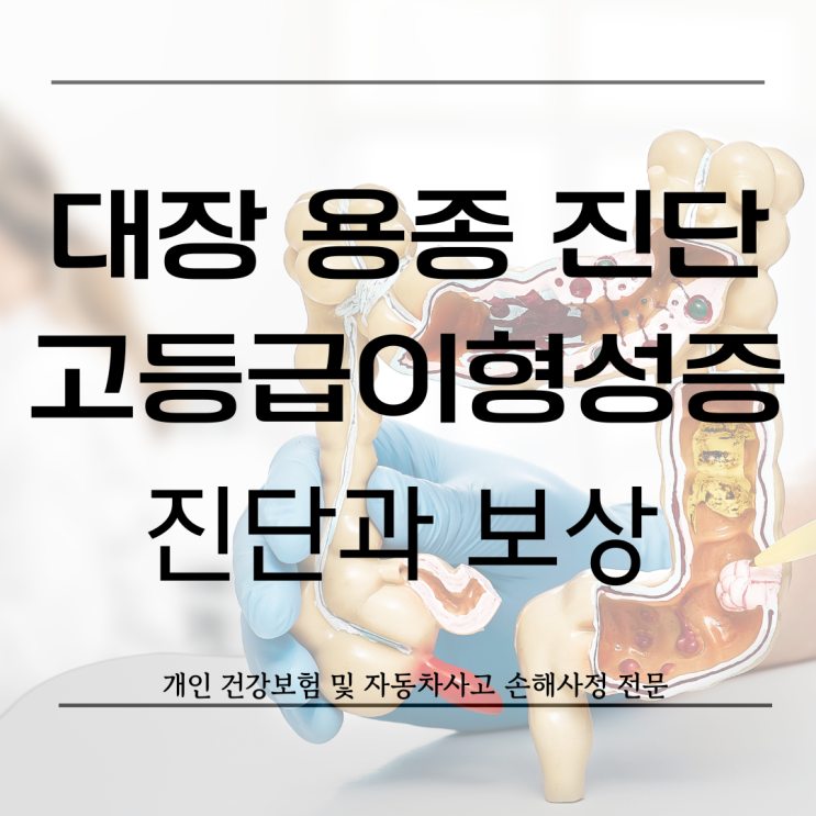 대장 내시경 중 용종 및 관상선종 상피내암(고등급이형성증) 진단과 보상에 대하여 : 네이버 블로그