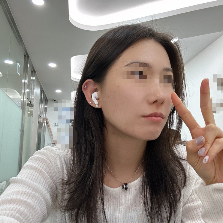 [부산실리프팅] 해운대 옆광대 맞춤 리프팅 후기, 통증, 효과 솔직 리뷰 : 네이버 블로그