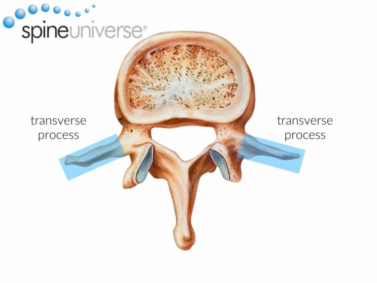 📌 디스크와 혼동하기 쉬운 허리 통증 시리즈 - 제3요추 횡돌기 종합증(Third Lumbar Transverse Process ...