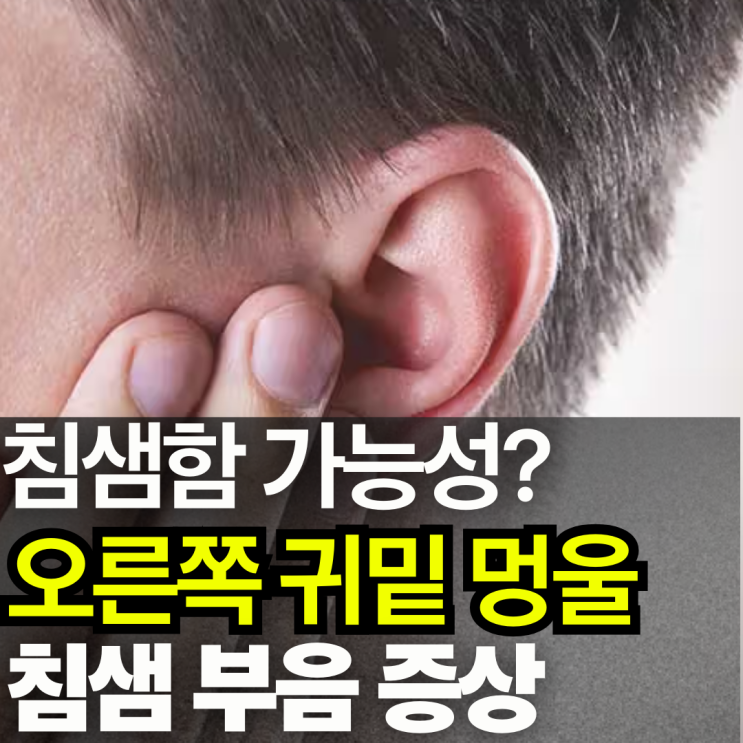 오른쪽 귀밑 멍울 원인, 침샘 부음 침샘암 증상 : 네이버 블로그