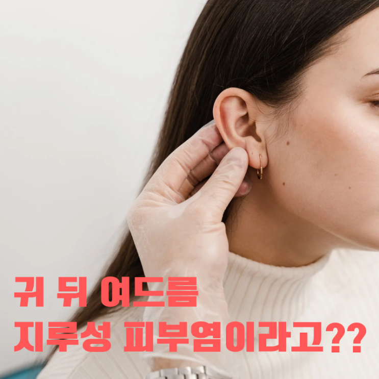 귀 뒤에 나는 뾰루지가 사실 지루성피부염일 수도 있다는 거 아셨나요? : 네이버 블로그