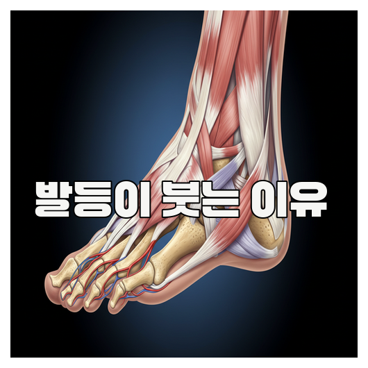 발등이 붓는 이유와 원인 총정리 : 네이버 블로그