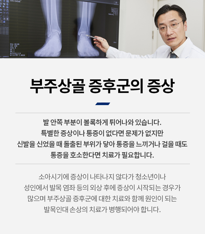 인대 손상 발견하면서 확인한 악세사리뼈 문제까지도 말끔히 : 네이버 블로그