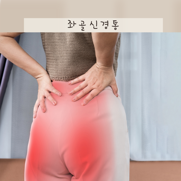 좌골신경통 원인 증상 치료 및 좌골신경통 운동 어떤 걸로 시작하면 좋을지 : 네이버 블로그