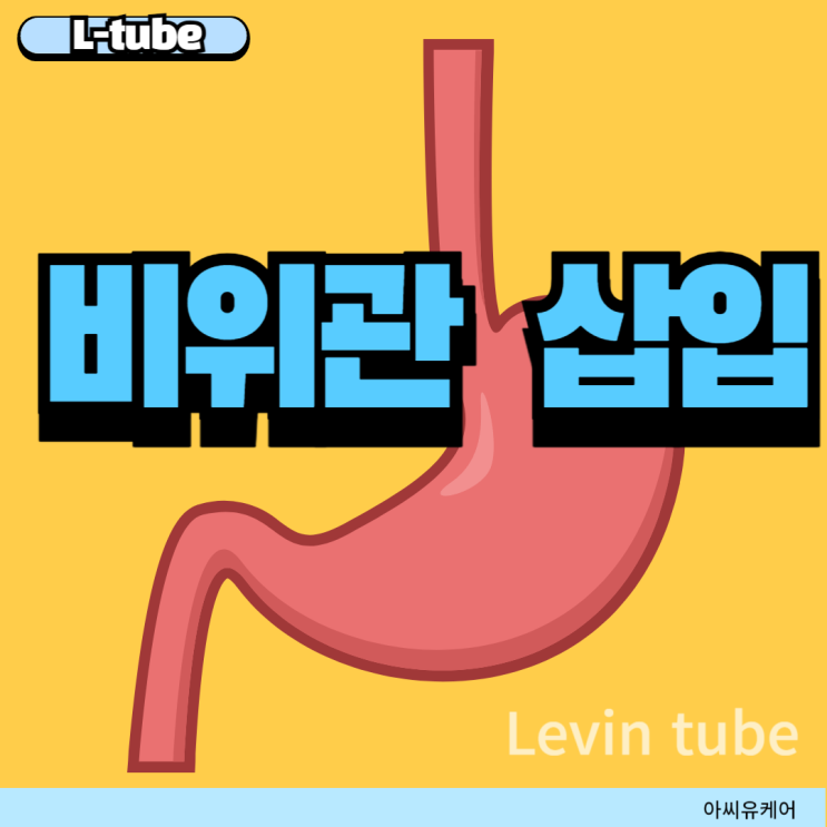 L-tube/Levin tube insertion, 비위관 삽입 : 네이버 블로그