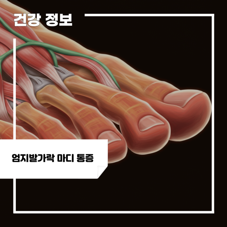 엄지발가락 마디 통증 원인 3가지, 치료 및 통증 해소법 : 네이버 블로그