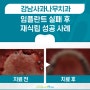 강남임플란트재수술, 또 실패할까 두려운 분들은 읽어주세요