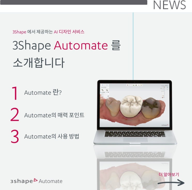 [카드뉴스] 3Shape 오토메이트를 소개합니다! : 네이버 블로그