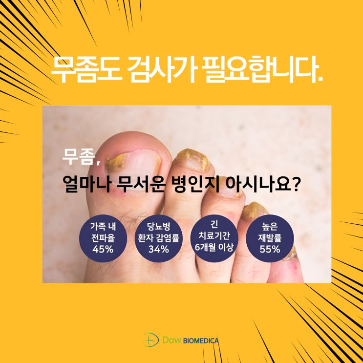 손발톱무좀(손발톱백선증) 신속항원검사 Diafactory : 무좀도 검사가 필요합니다. : 네이버 블로그