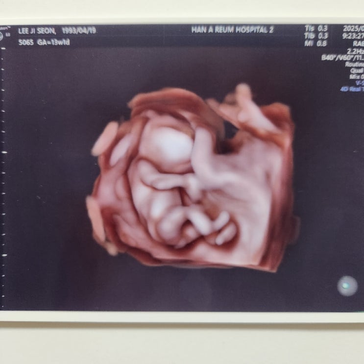 👼임신 13주차 일기(1) 소화안됨 이슈 : 네이버 블로그