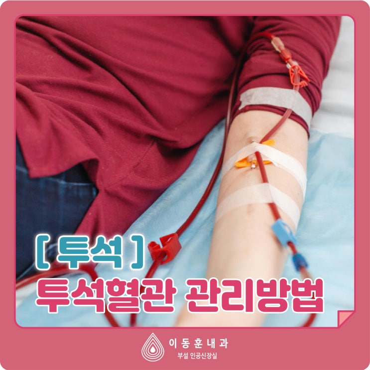 [투석] 투석혈관 관리방법 : 네이버 블로그