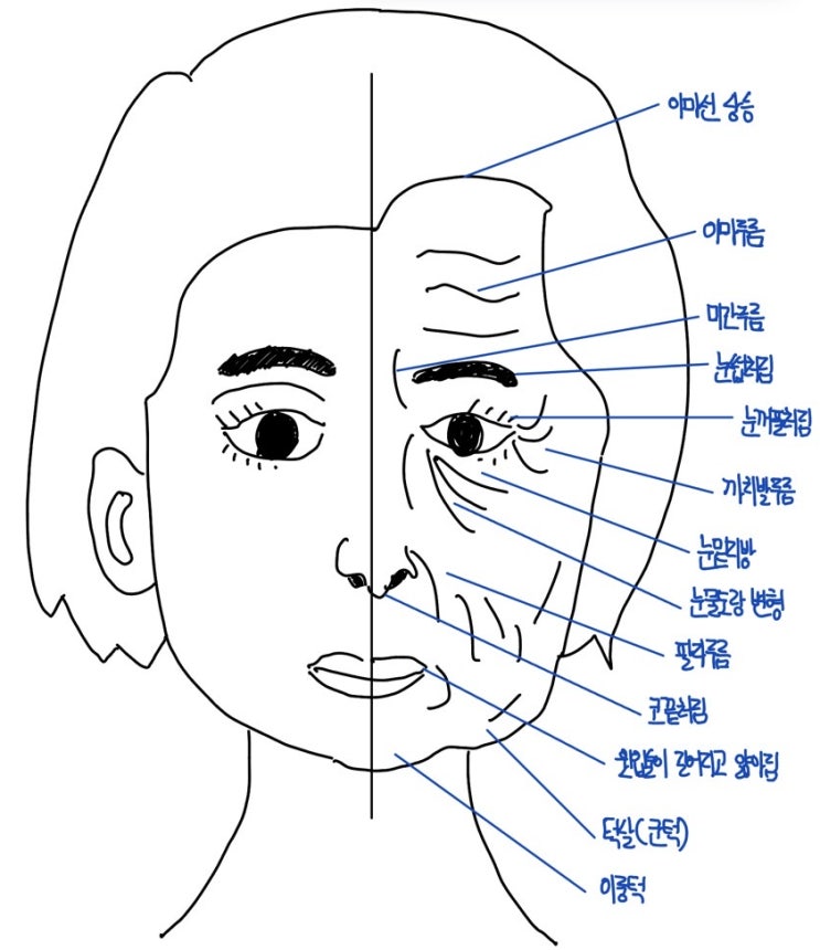얼굴 피부와 피하구조물의 노화과정 : 네이버 블로그