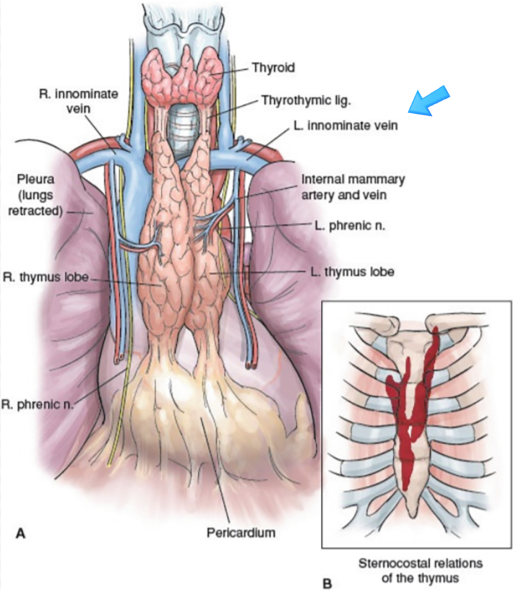 Left Innominate (Brachiocephalic) vein과 Thymoma의 위치 관계 : 네이버 블로그