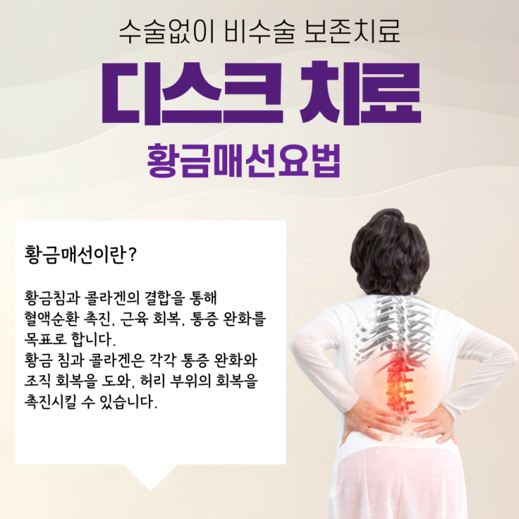 시흥한의원 금침 황금매선 비수술 보존치료 : 네이버 블로그
