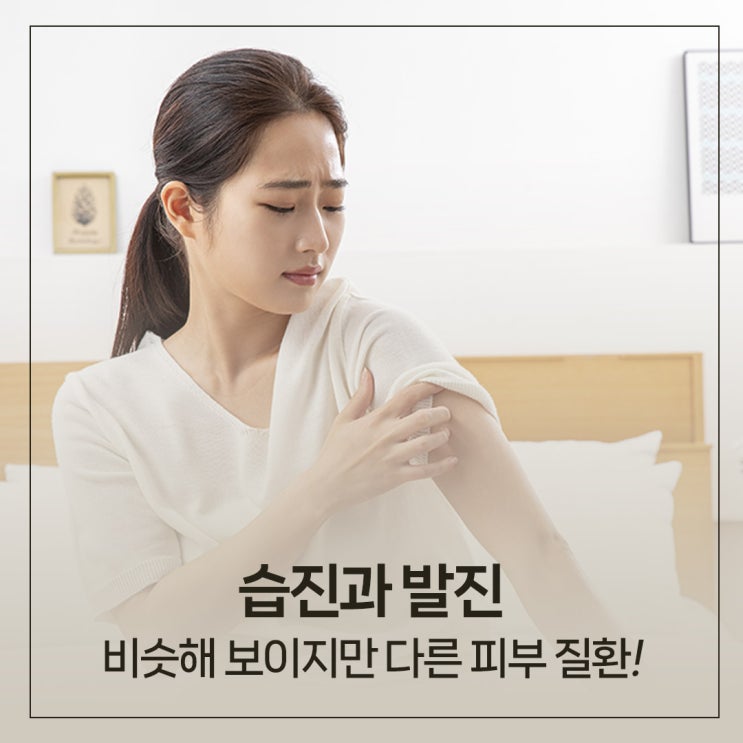 습진과 발진 차이점, 부산남천동피부과에서 알려드려요~! : 네이버 블로그