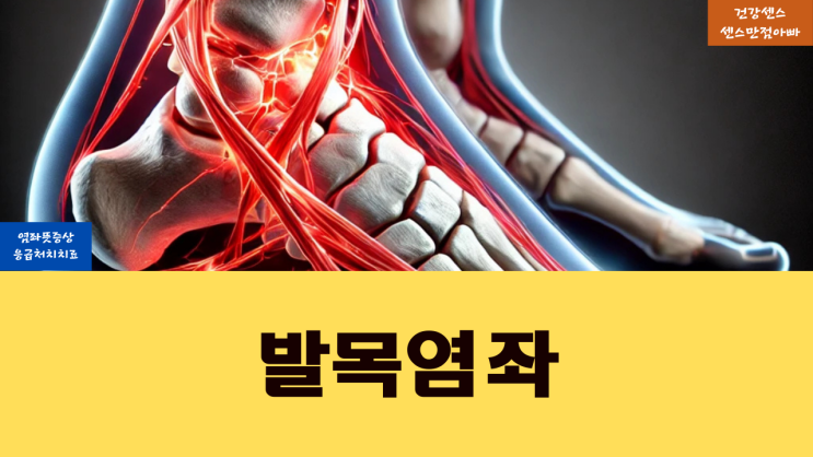 염좌 뜻 발목 염좌 증상 및 응급처치 치료 알기 : 네이버 블로그