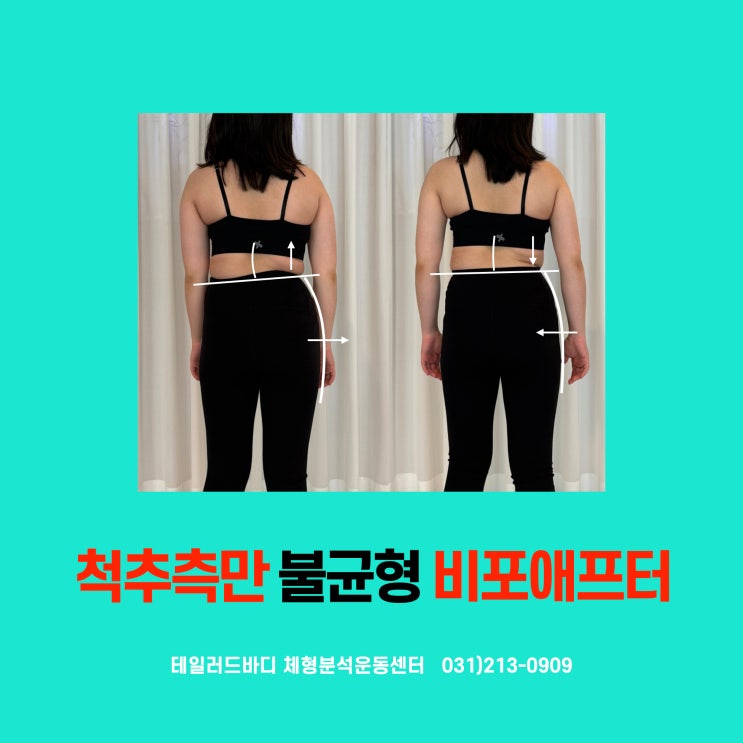 성남 척추측만 생리통이 심한 이유 : 네이버 블로그