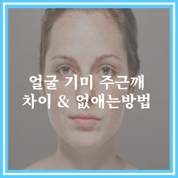 얼굴 기미 주근깨 차이 제거 없애는방법 생각보다 쉽네? : 네이버 블로그