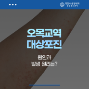 오목교역 대상포진 원인과 발생 원리는?