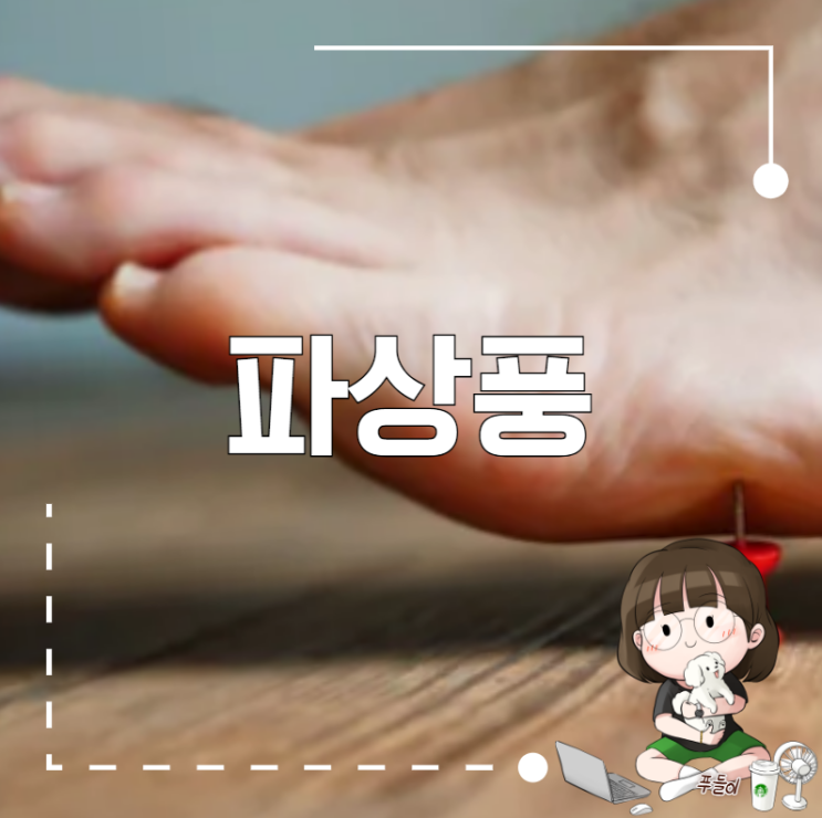 파상풍 초기증상, 파상풍 주사 TD예방접종 알아봐요 : 네이버 블로그