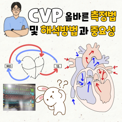 CVP 중심정맥압 중요성과 올바른 CVP wave 해석법 그리고 측정하는 올바른 방법은? : 네이버 블로그