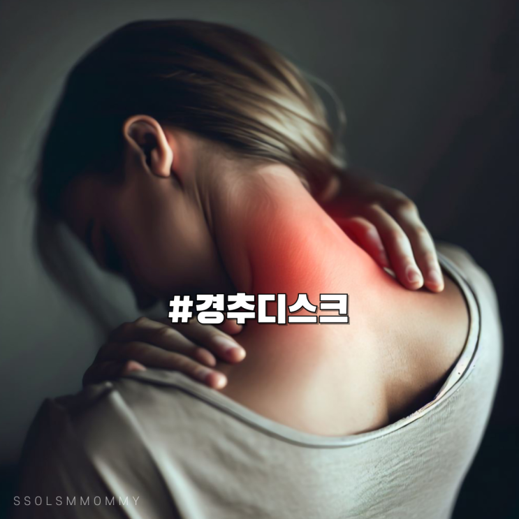 경추디스크 목이 뻐근한 목통증 : 네이버 블로그