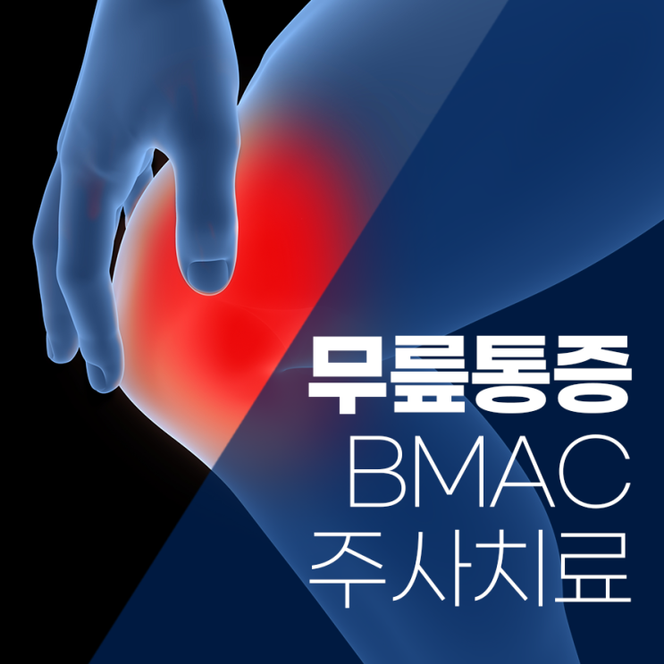 인천연세병원 매일경제 의료칼럼, 무릎관절염 BMAC 골수 줄기세포치료 : 네이버 블로그